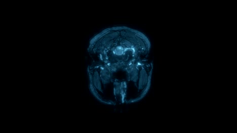 magnetic resonance imaging mri scan of a human brain, ultra hd 4k, time lapse. x-ray, computed medical tomography. medical blue color