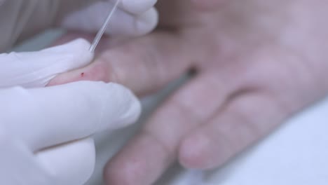 taking blood sample from finger. close up of hands in glove draw blood finger