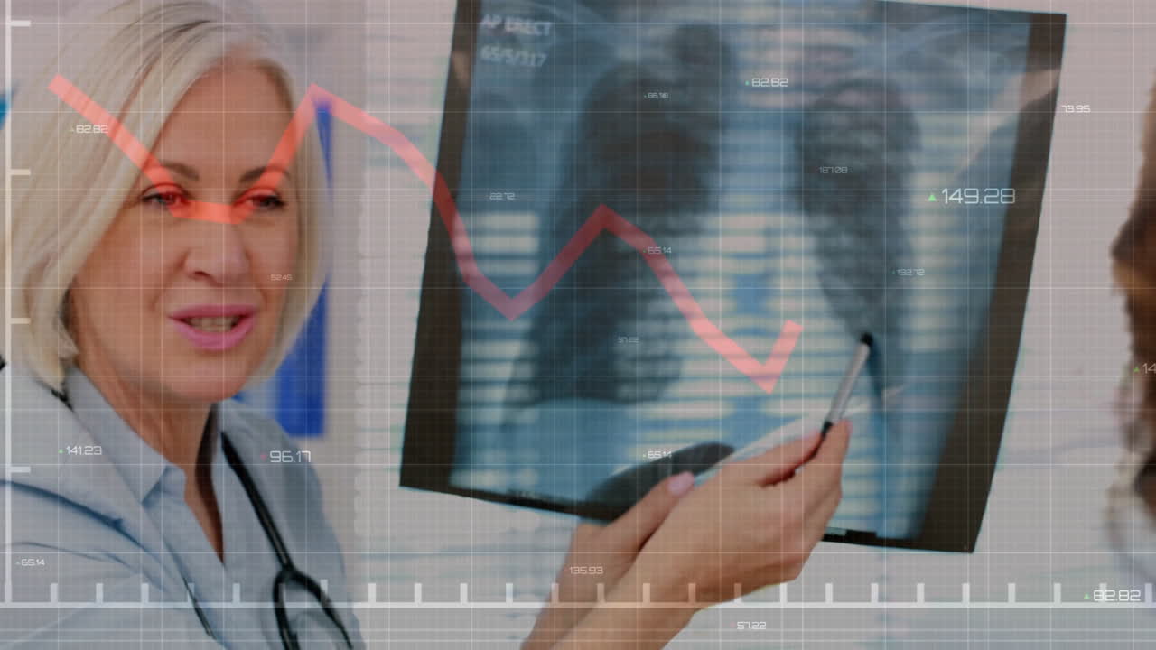 Analisi di una radiografia con grafici finanziari in sovrimpressione, medico in uno studio medico.
