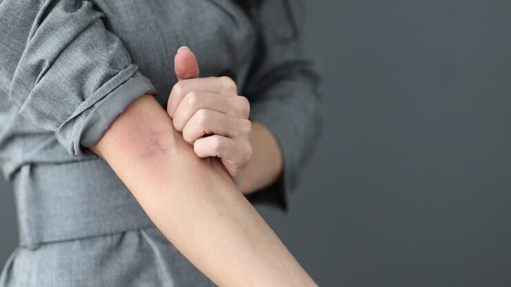 Person scratching an itchy, red rash on their arm