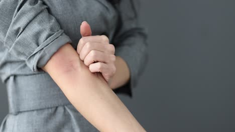 person scratching an itchy, red rash on their arm