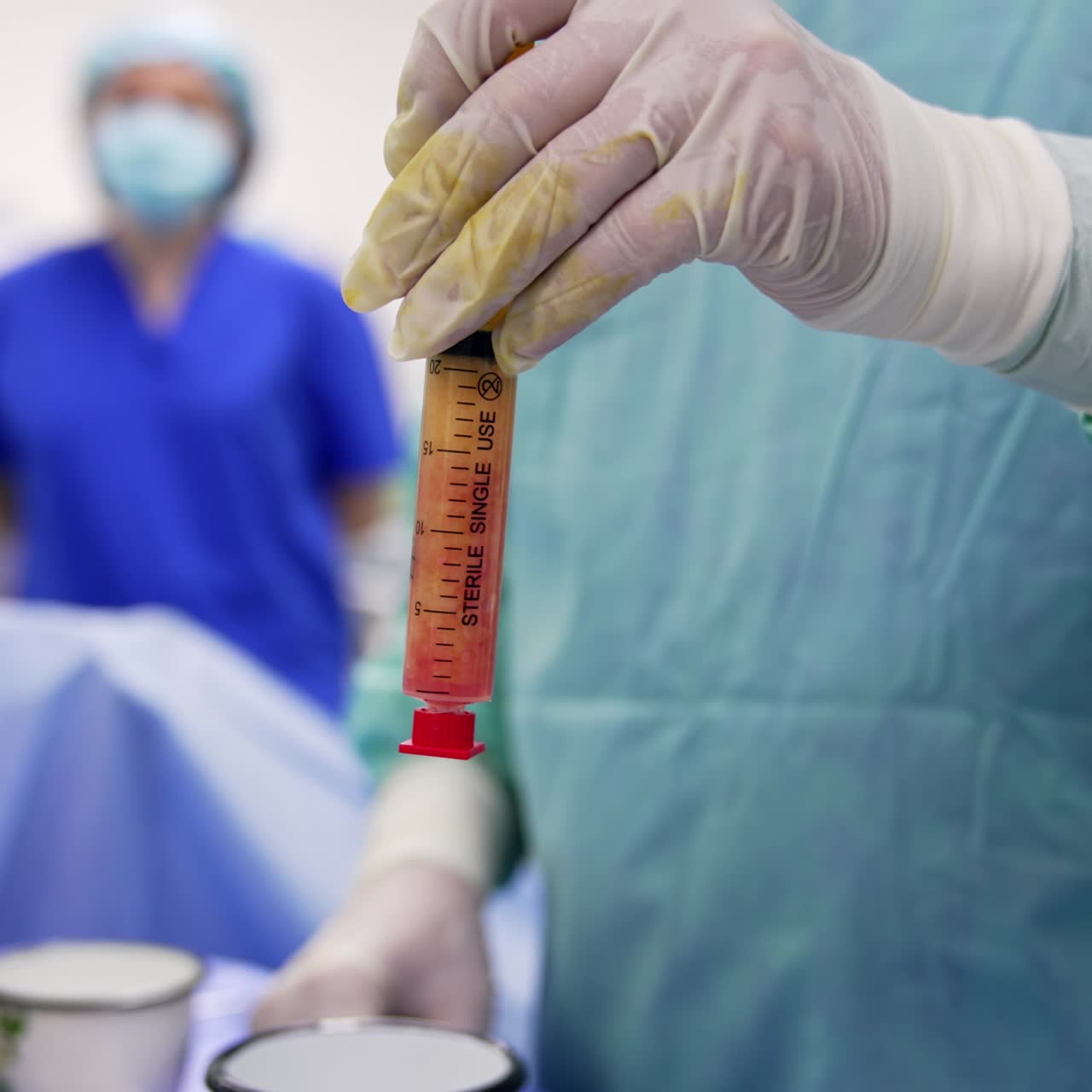 Doctor's hand in latex gloves hold a syringe filled with stem cells. Close up. Female medic standing at backdrop in blur