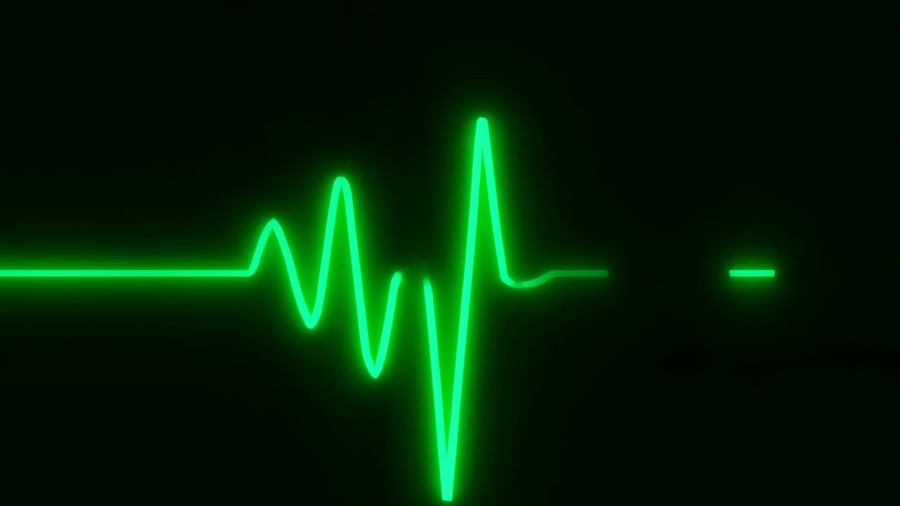 Traccia in stile elettrocardiogramma verde neon brillante che si muove su uno schermo scuro con picchi intermittenti, cime arrotondate, brevi avvallamenti e sezioni piatte, creando un segnale medico luminoso con forte