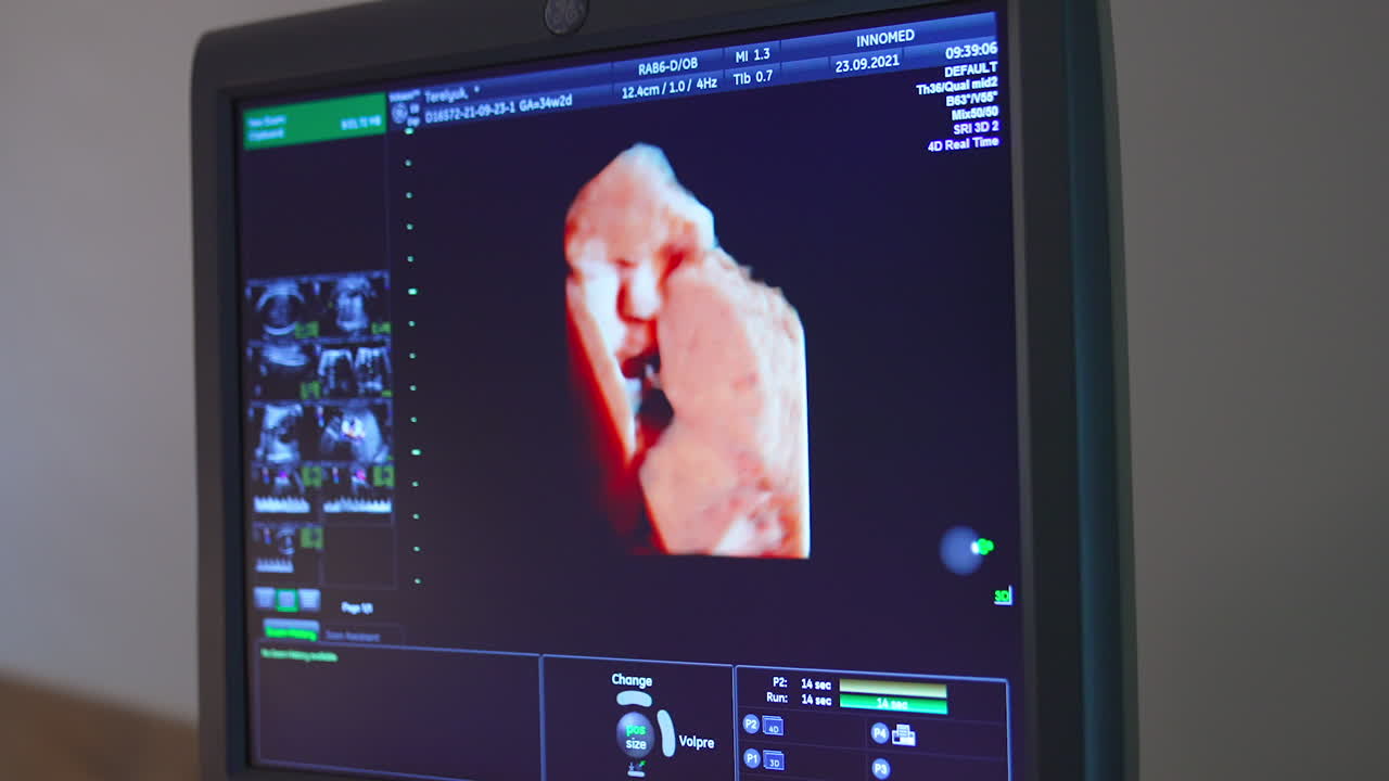 Baby moving in mom's belly shown at the screen. Life parameters on the blue monitor. Close up.