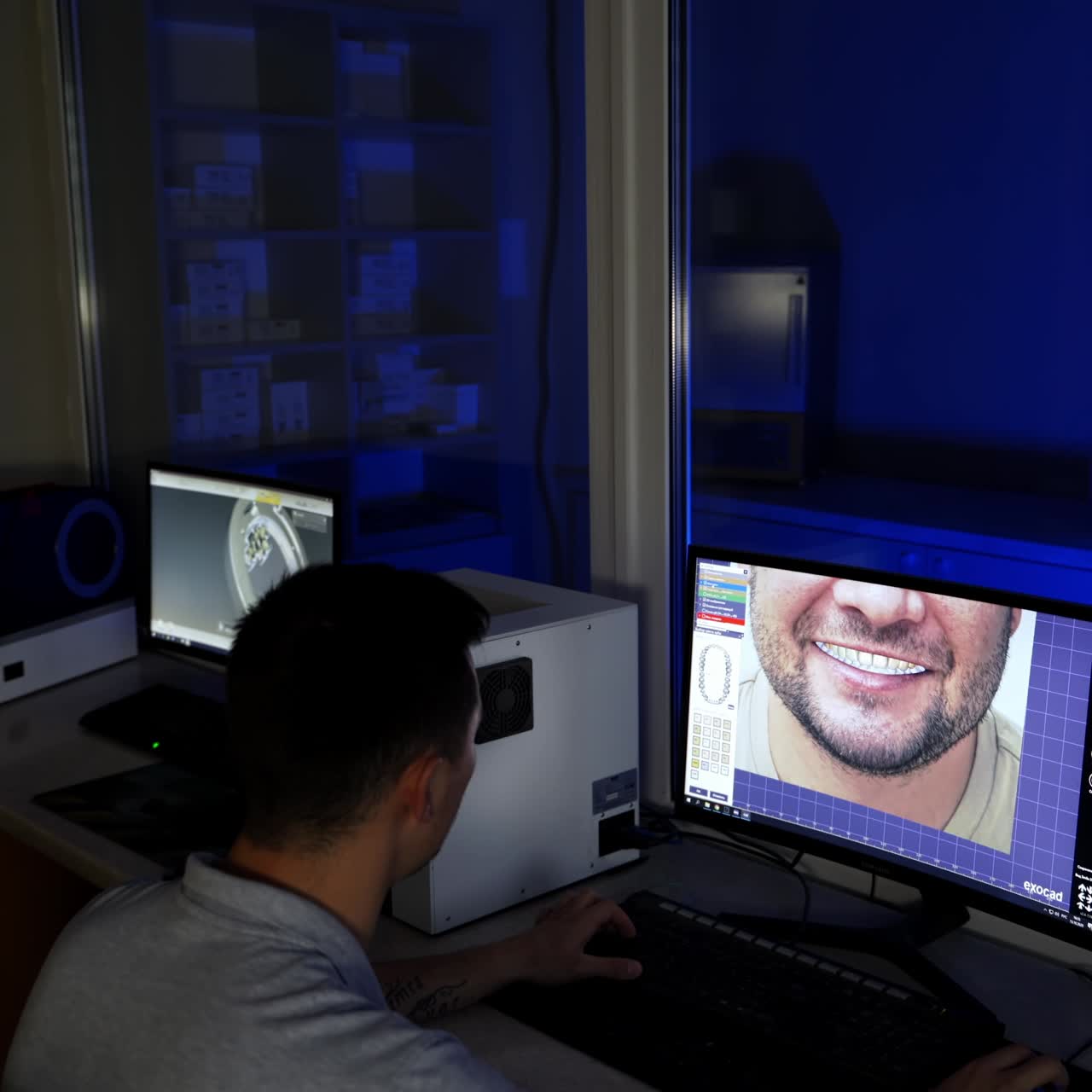 Process of manufacturing dentures in dental lab