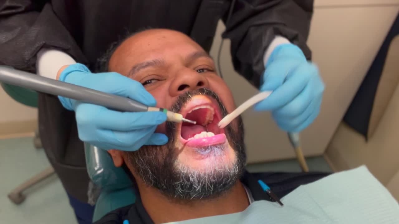 una vista de cerca de un hombre de mediana edad con barba en el dentista