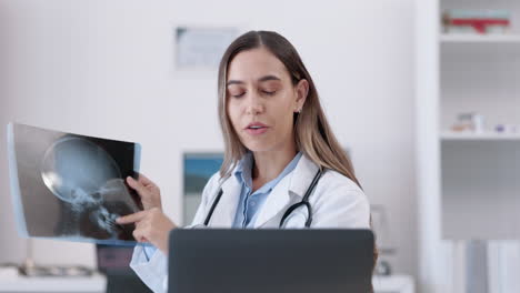 Atención-Sanitaria,-Mujer-Y-Médico-Con-Una-Radiografía.