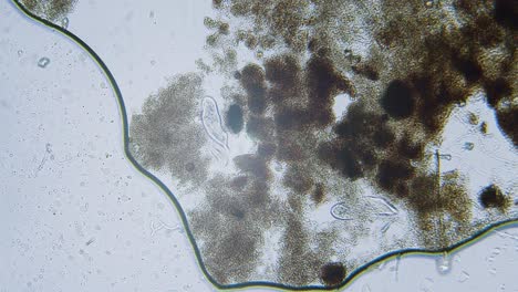 Diferentes-Especies-De-Agua-Dulce-De-Protozoos-Organismos-Unicelulares-Como-Estentores,-Ciliados-Y-Movimiento-De-Algas-Bajo-El-Microscopio-Vista-Archivada-Brillante