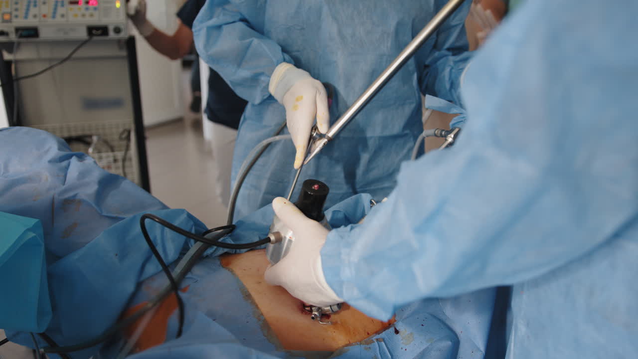 cirugía abdominal laparoscópica