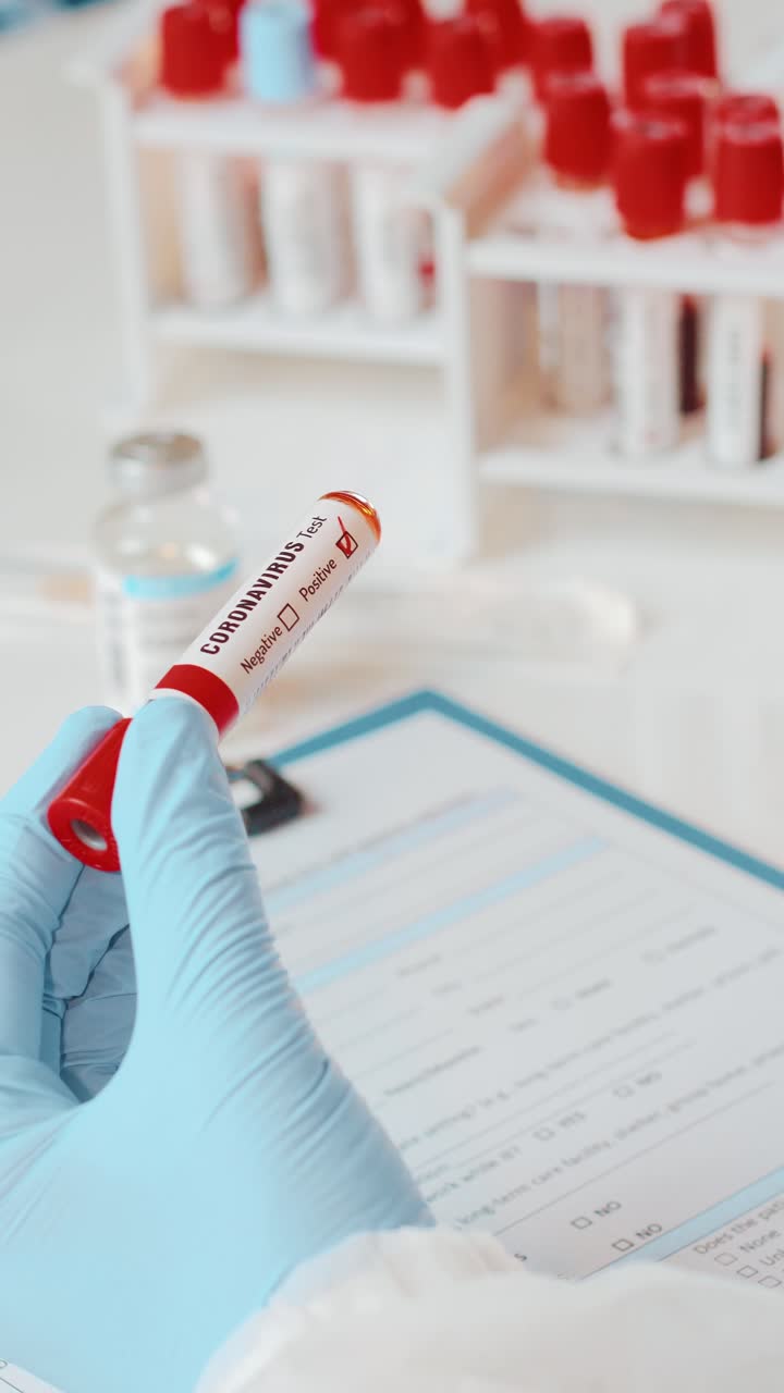 prueba de coronavirus en un laboratorio