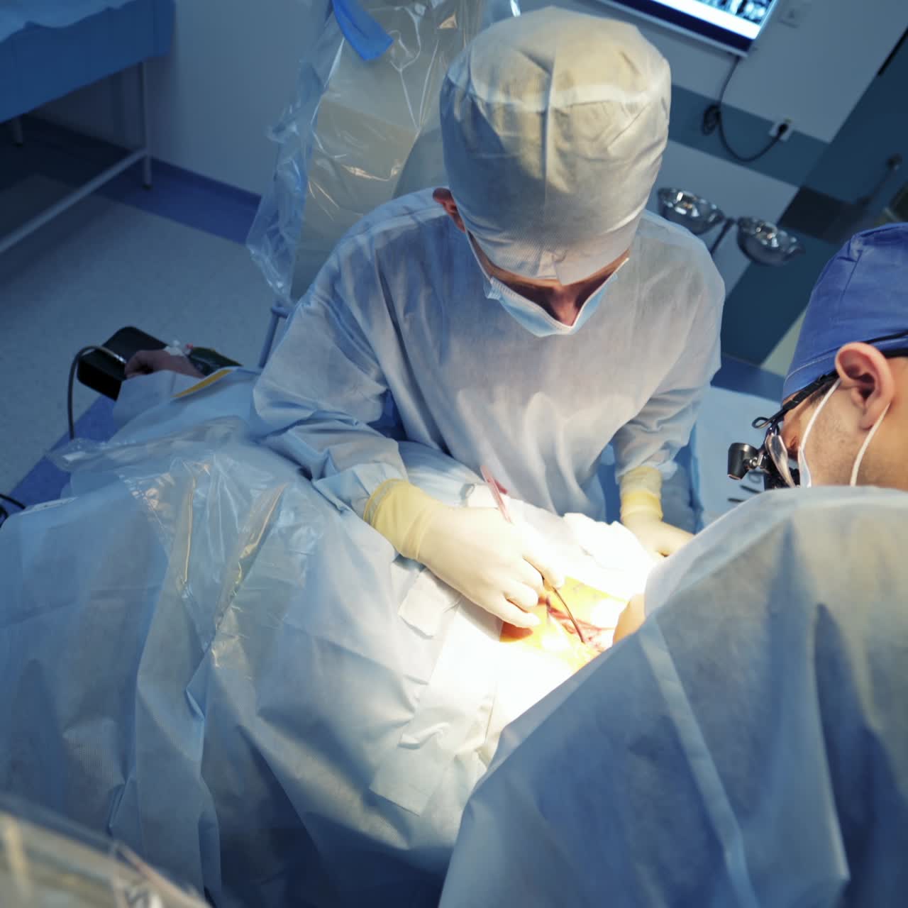Neurosurgery operation room with special equipment. Two doctor`s provide operation on the patient. Selective focus