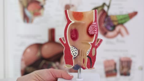 close-up of an anatomical model of the rectum for medical education