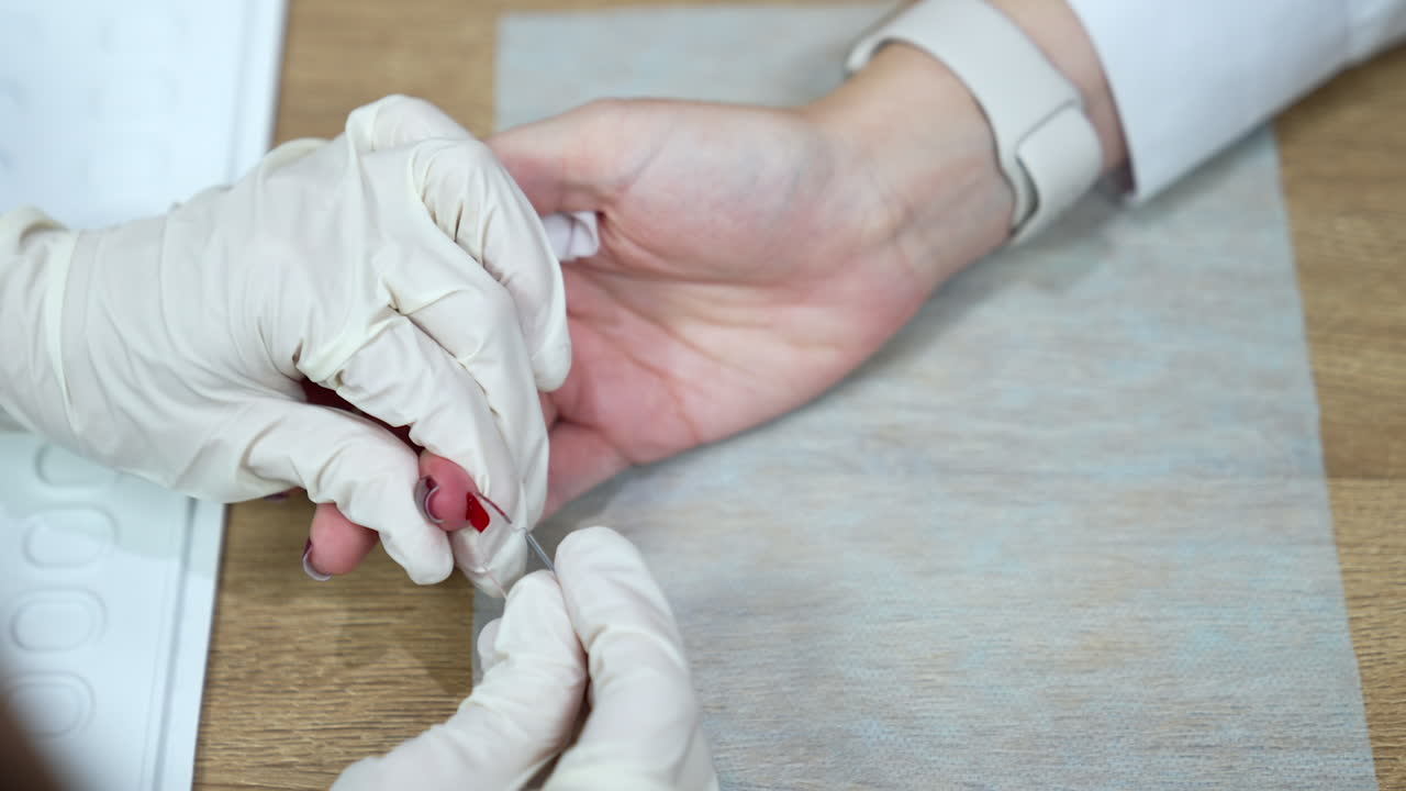 Nurse's hands in latex gloves take blood from a female patient. Close up. Blood donation in the hospital.