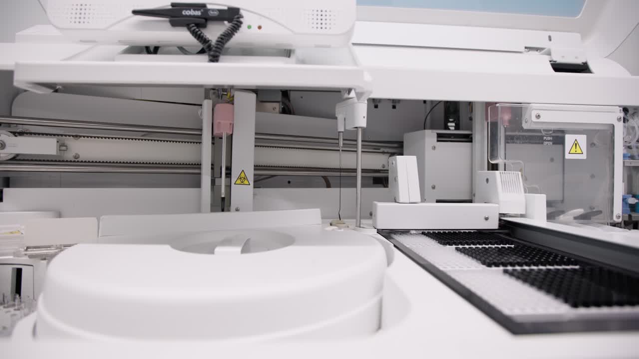 임상 실험실에서의  ⁇ 플 분석기