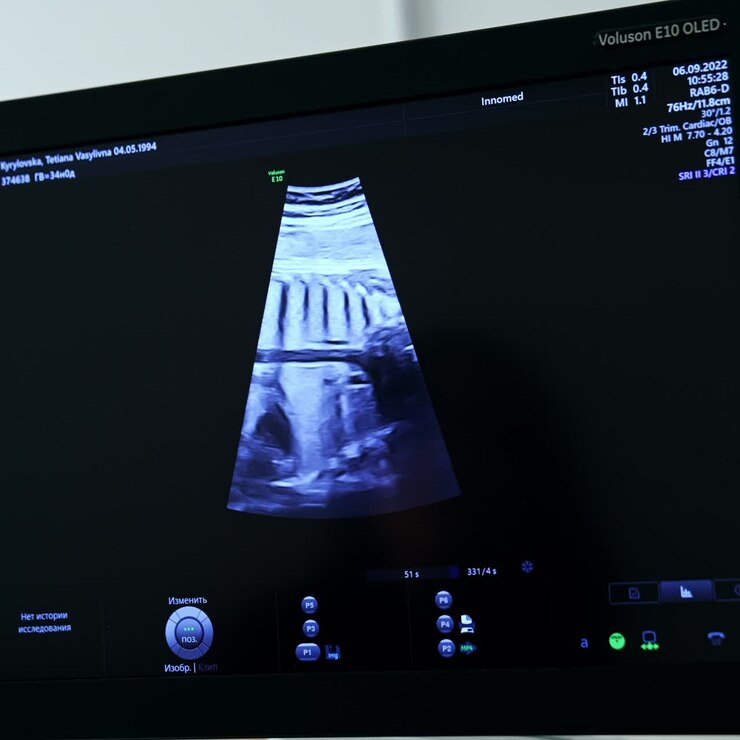 Observation of a child development in the mother's belly. Monitor of the ultrasound equipment with child's organs. Close up