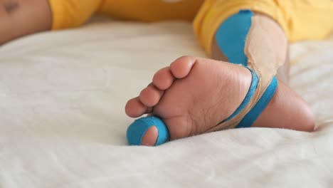 closeup of a baby's foot with a blue and beige bandage on the ankle and toes