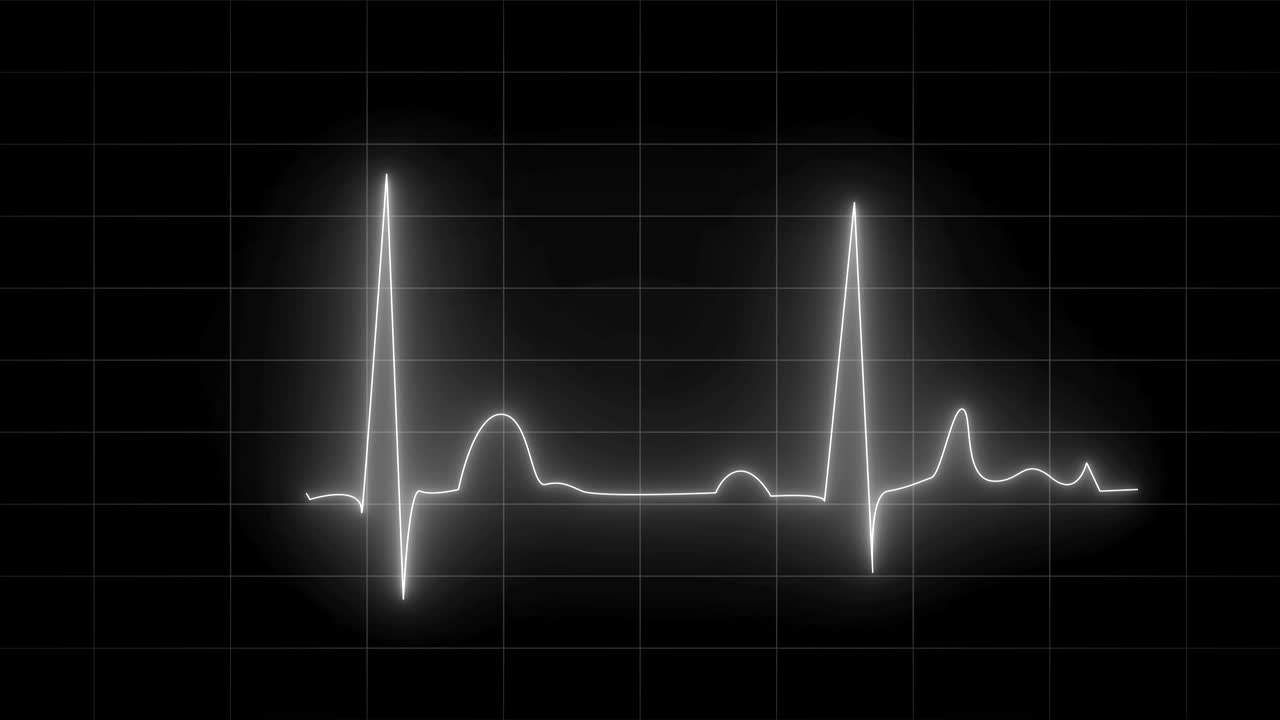 cardiograma de 4k - animación de ecg (en blanco y negro)