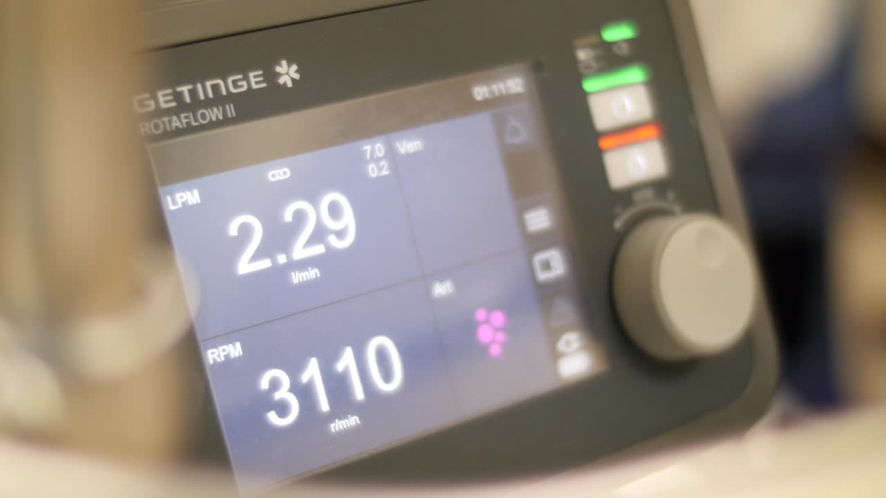 심장 치료를 위한 중환자실의 의료 장비