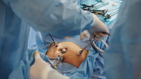 laparoscopic abdominal surgery