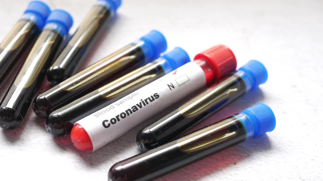 Blood Sample Coronavirus Test Tubes