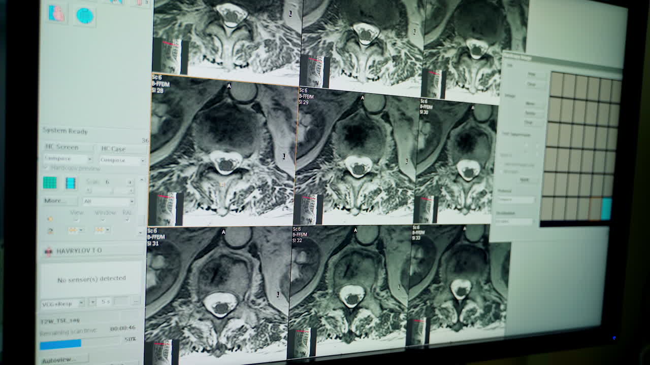 Collage of many x-rays. Chest x-ray film of patient at hospital