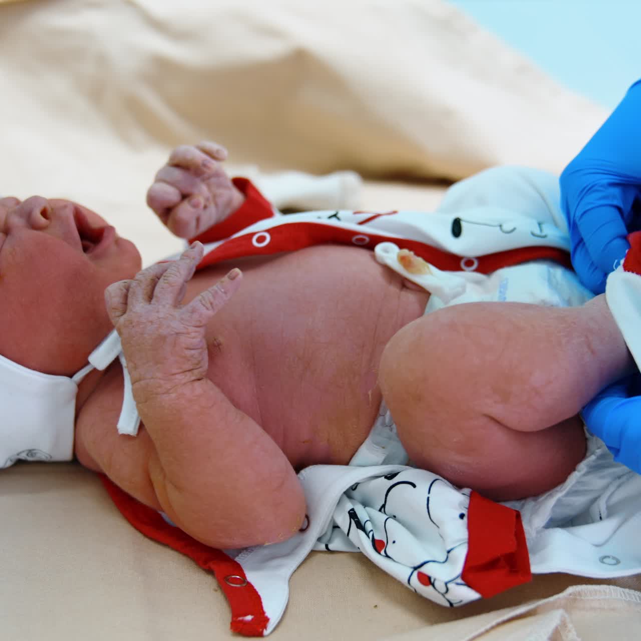 Crying newborn id dressed by the gloved hands of medic. Little child on the doctor's table. Close up