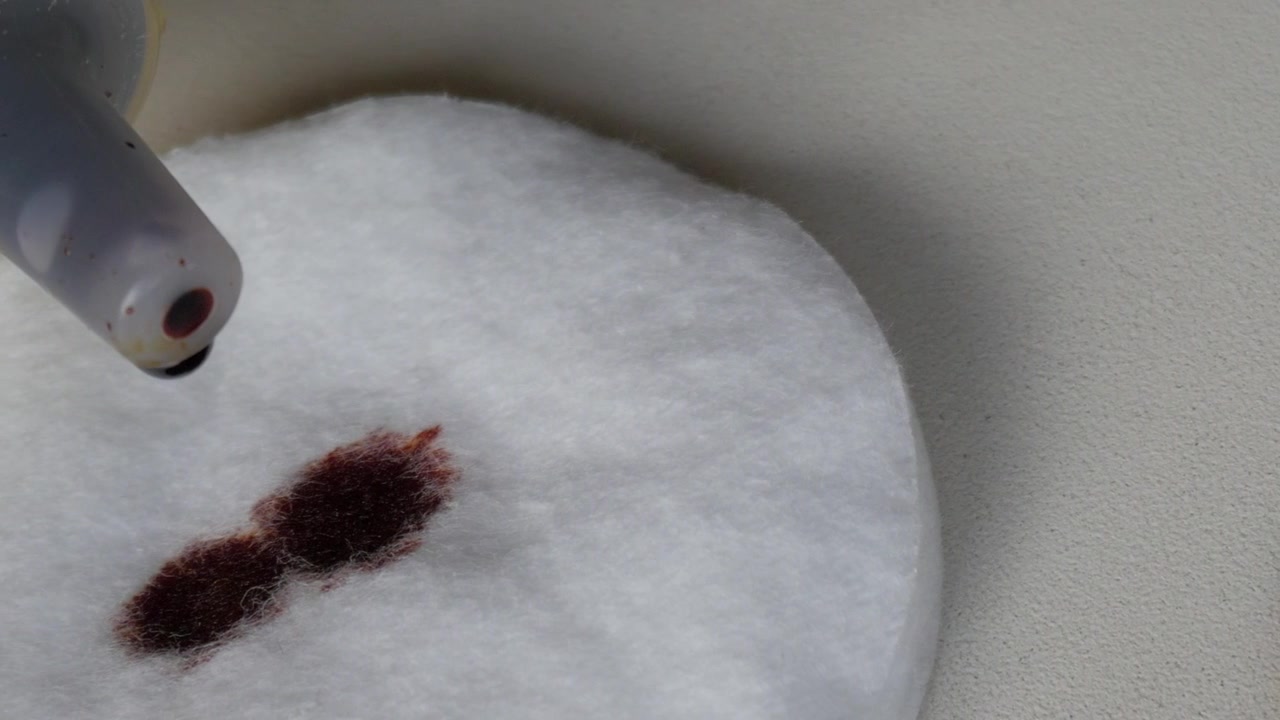 Primo piano del beccuccio di una bottiglia di prodotto medico con una goccia rosso scuro accanto a un dischetto di cotone bianco con gocce dello stesso. Strisce