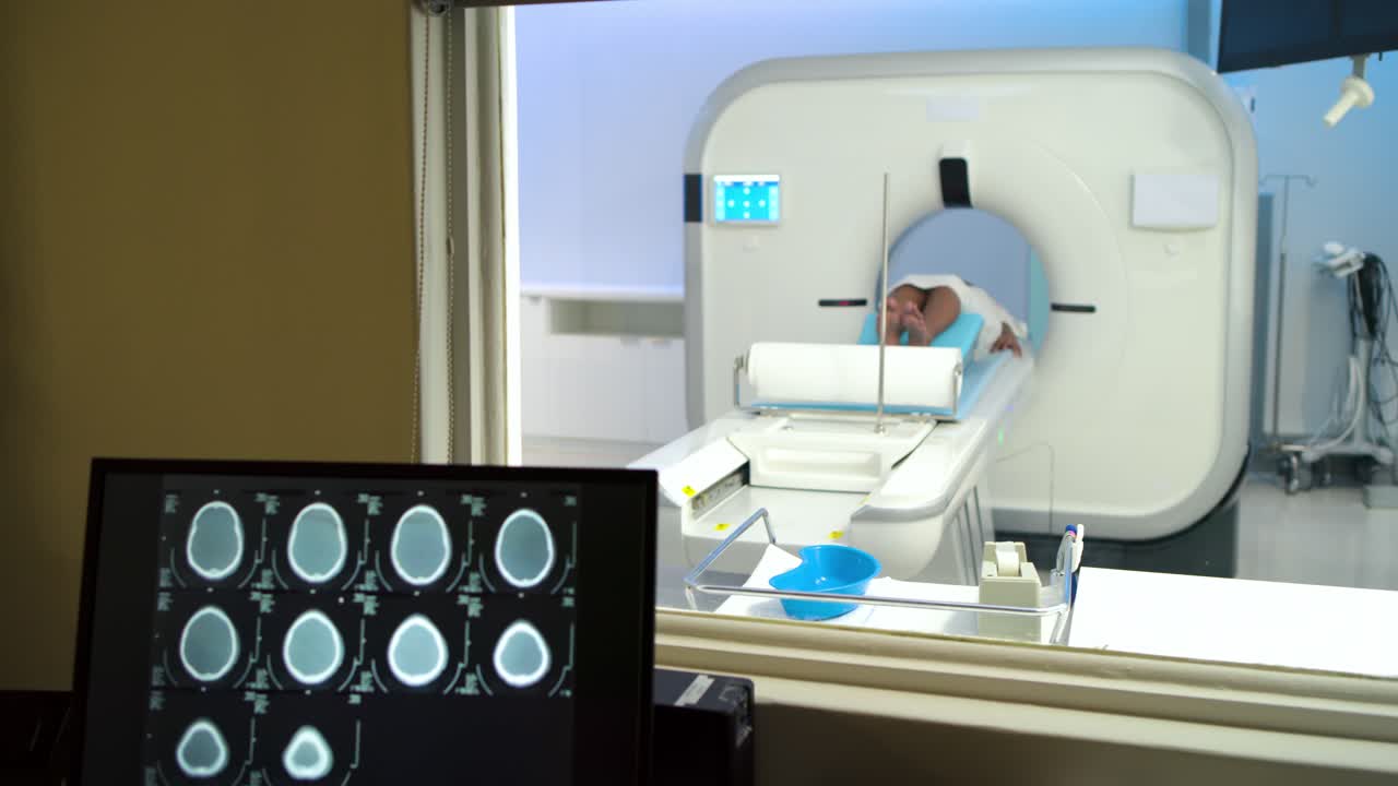 Un tecnico sta toccando un tablet per avviare una scansione TC, mentre il paziente si sta inserendo nel gantry per un'imaging cerebrale.