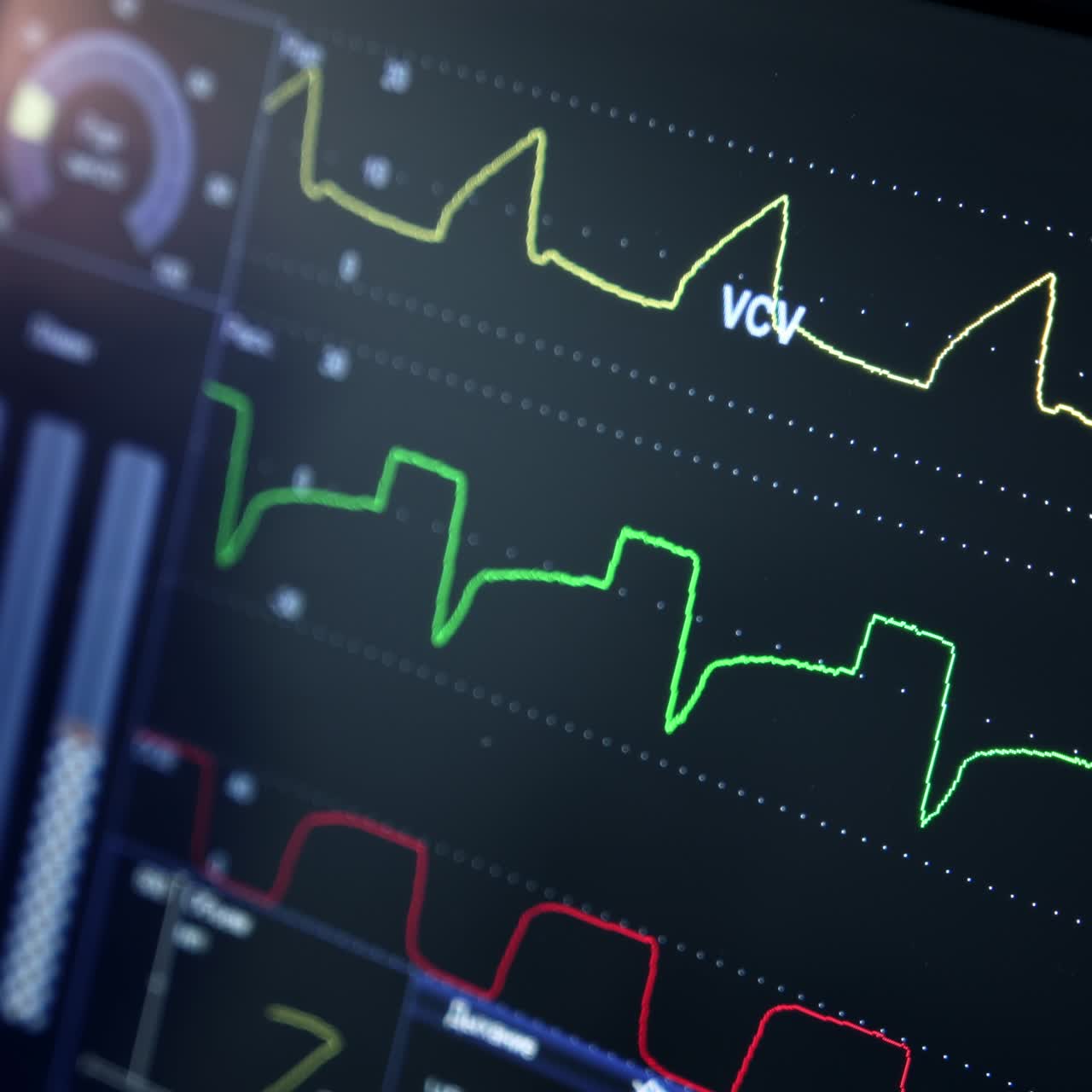 Slowly running curves of a life sign at the back screen. Lung ventilator monitor close up