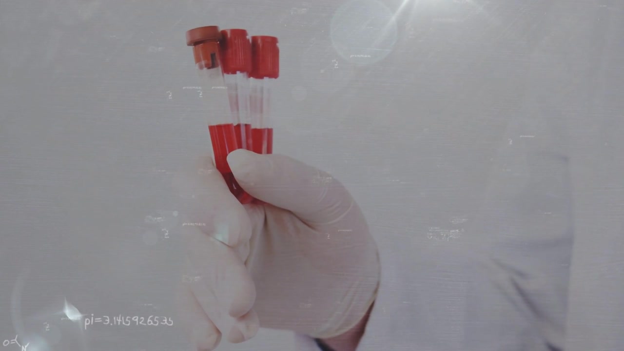 Gloved hand holding redcap vials in clinic lens flare causing overlays showing analysis above vials