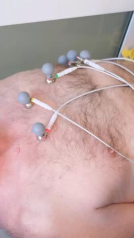 the doctor performs electrocardiography ecg, a method of graphic recording of electrical phenomena that occur in the heart muscle during its activity.