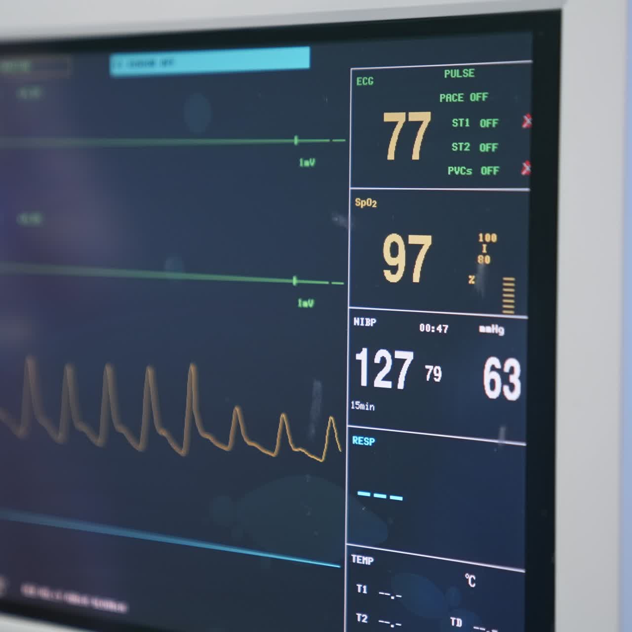 Different vital parameters of a patient shown on the screen of equipment at surgery room. Close up