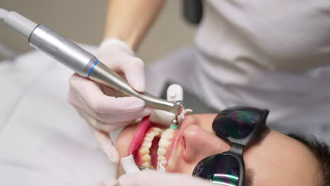 stomatologist polishing patient's teeth. face of a woman in black glasses with opened mouth treating her teeth in dental cabinet. close-up.