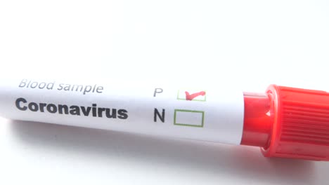 coronavirus blood sample test