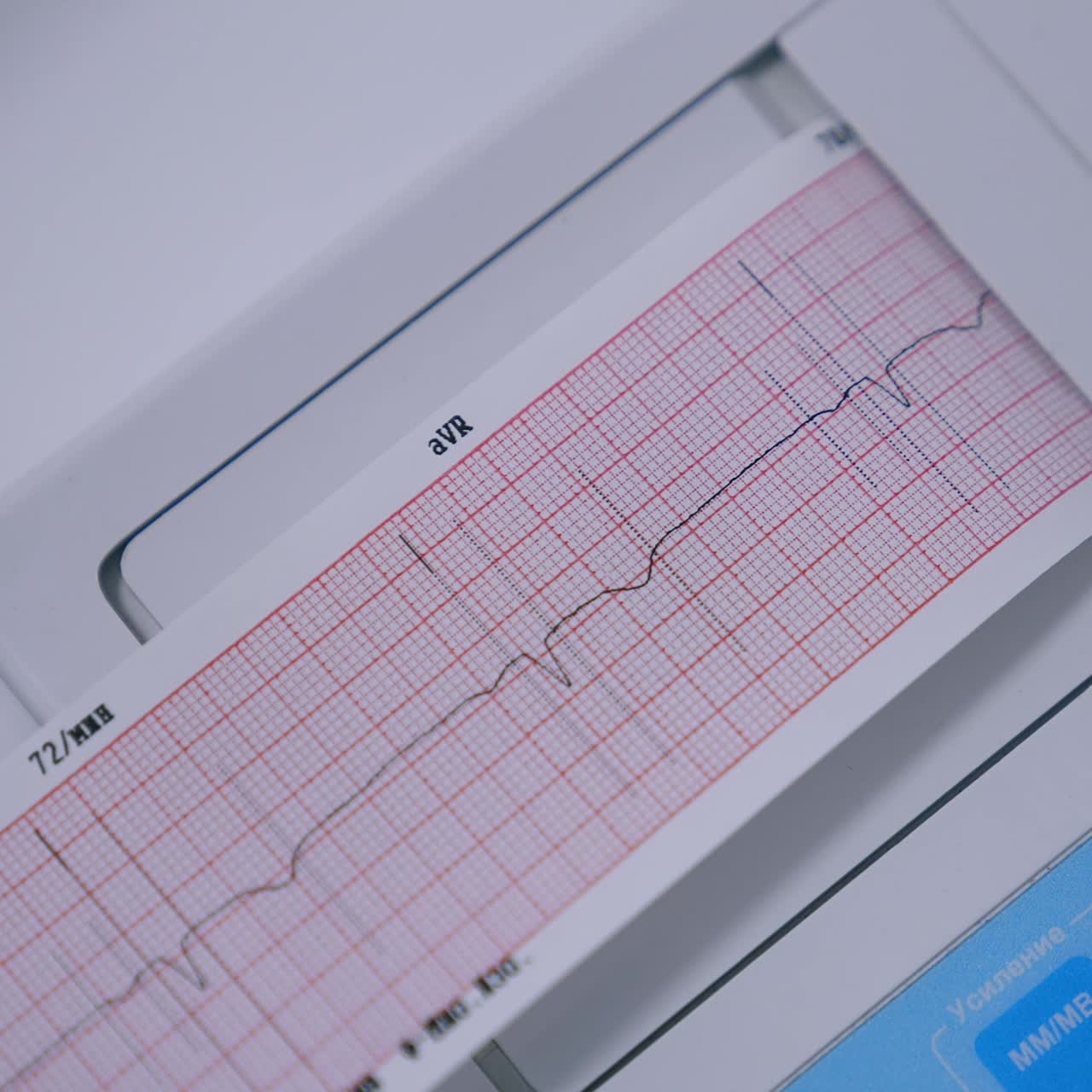 Esaminando la frequenza cardiaca e il battito cardiaco su apparecchiature mediche. Primo piano. Risultato del test visualizzato sulla carta speciale.
