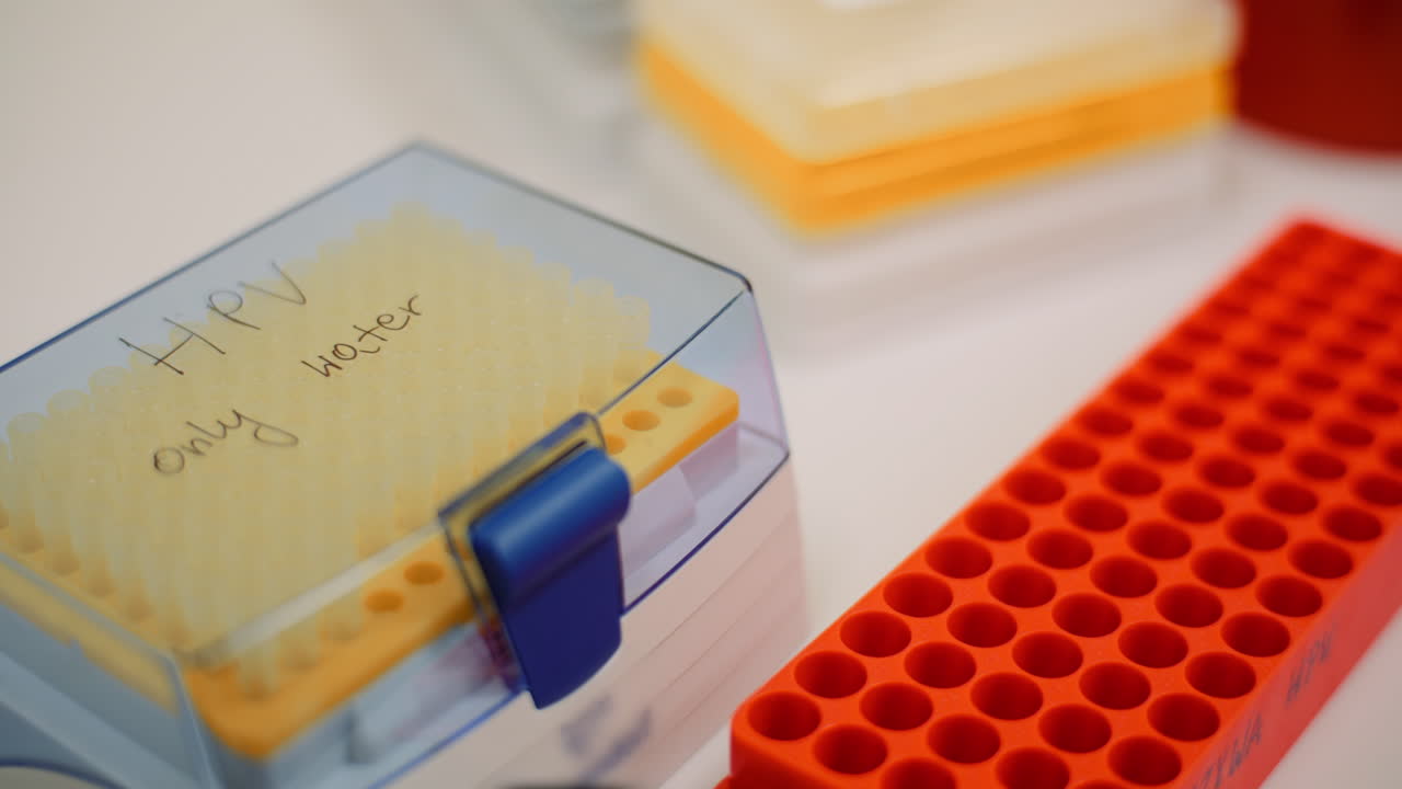 Primo piano di puntali per pipette da laboratorio e portaprovette