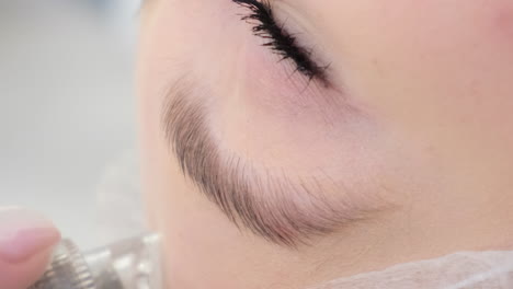micro-needling facial treatment