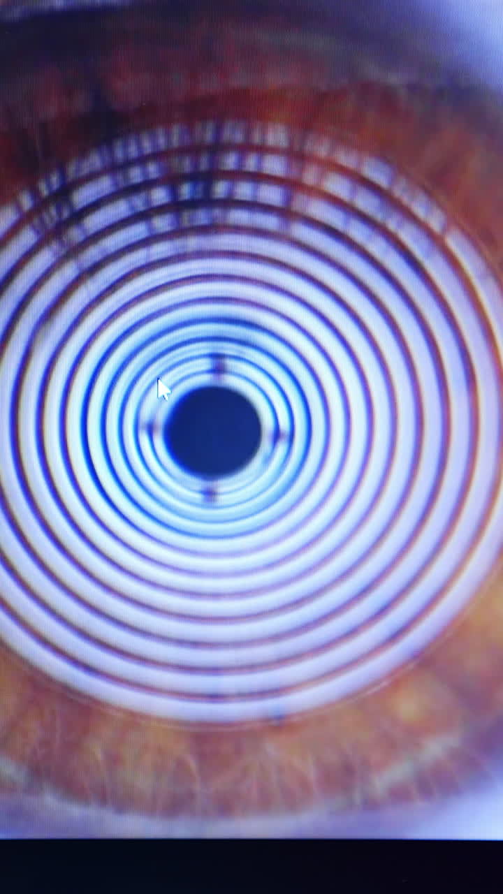 Eye Examination Image