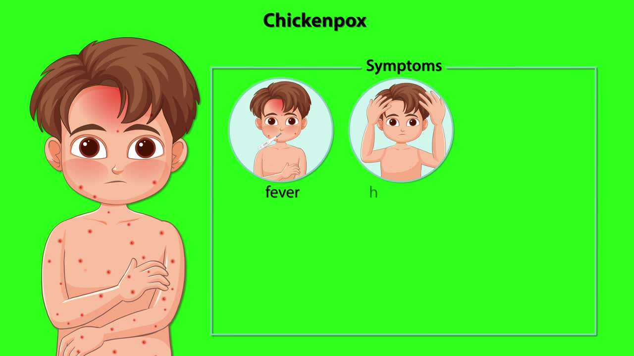 Cartoon boy develops chickenpox symptoms, with labeled icons and text, on bright green background