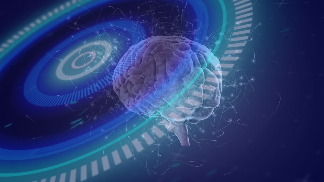 뇌 위의 스 ⁇  스캐닝의 애니메이션