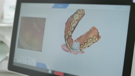 doctor scans the patient's teeth in the clinic. the dentist holds in his hand a manual 3d scanner for the jaw and mouth. dental health. creates a 3d model of teeth and gums on a medical monitor.