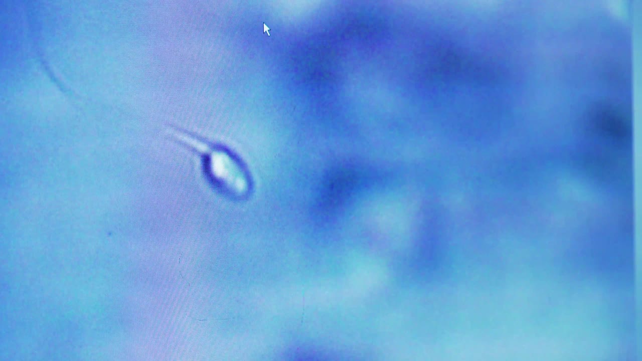 foto macro de un espermatozoide en movimiento