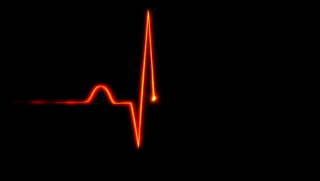 electrocardiogram heartbeat animation