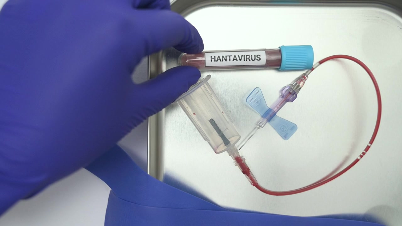 Laboratory technician drawing a blood sample for a hantavirus test on a white background
