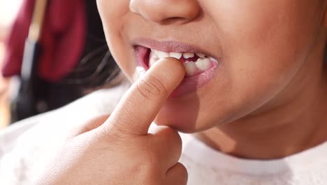 child with missing tooth