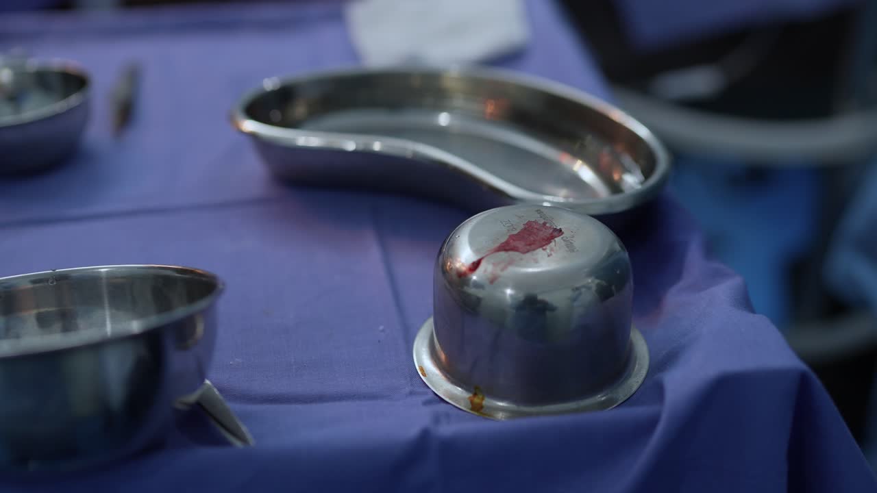 Dettagliata inquadratura della fotocamera incentrata su vassoi di strumenti chirurgici e panni sterili blu macchiati di tracce di sangue all'interno di una sala operatoria affollata in un ospedale pakistano