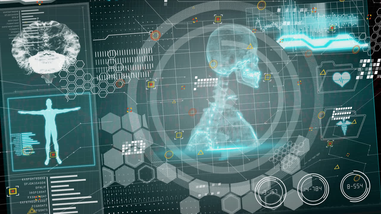 스 ⁇ 레트 위의 데이터 처리의 애니메이션