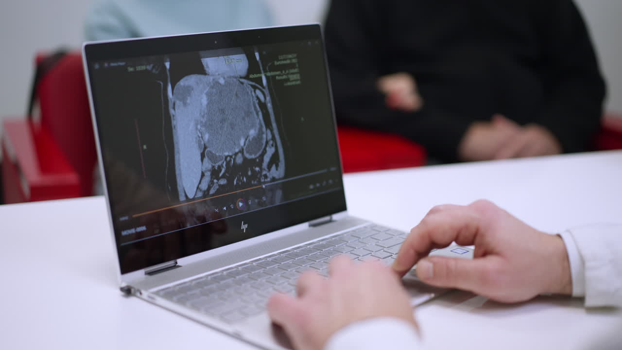 Analisi di immagini mediche su un laptop