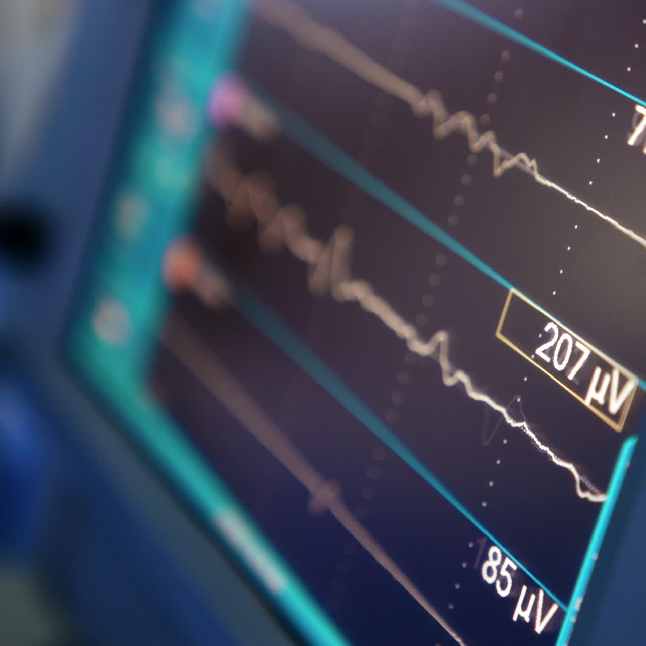 Curved lines run and figures change quickly on the monitor of lung ventilator. Top close up view on the medical equipment.