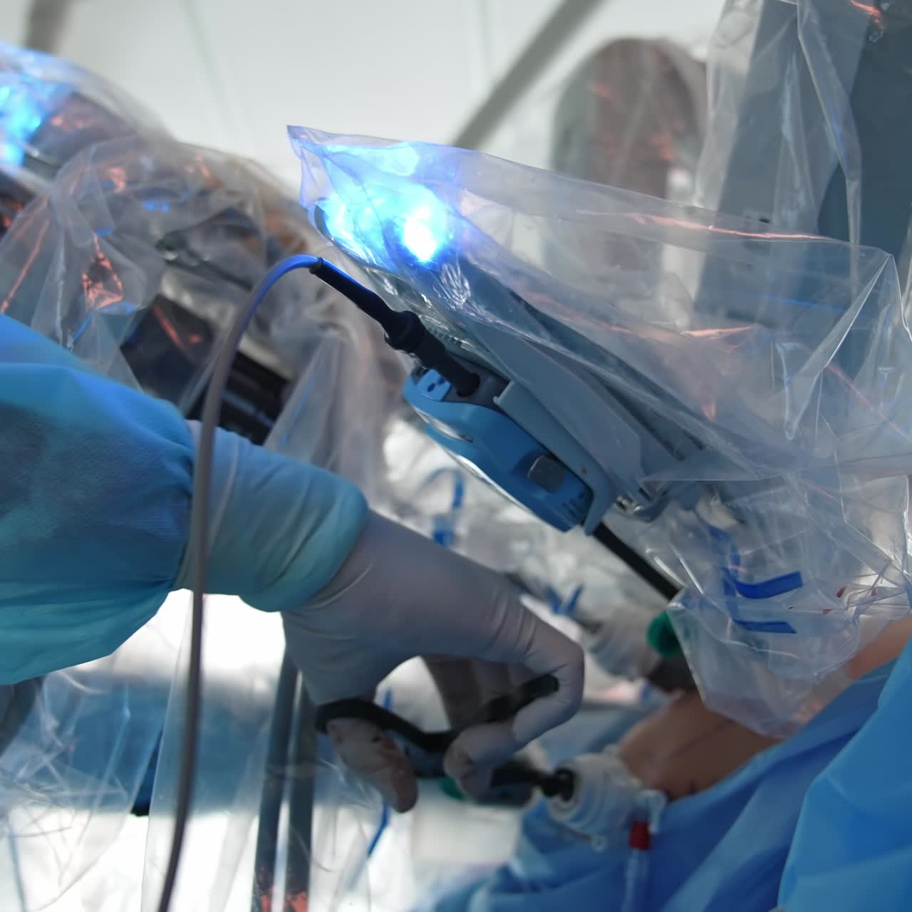 Robotic machine arms during surgery. Doctor is doing surgery with the help of robotic equipment. Medical operation involving robot in clinic. Close-up